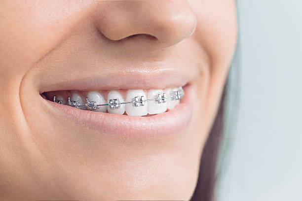 Best Teeth Whitening  in , MN